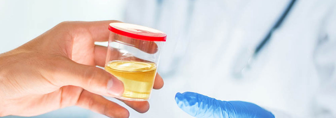 infection urinaire
